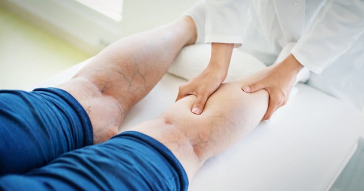 Closeup side view of unrecognizable female doctor massaging legs and calves of a senior female patient with visible varicose veins.