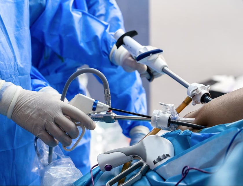 laparoscopic_surgery