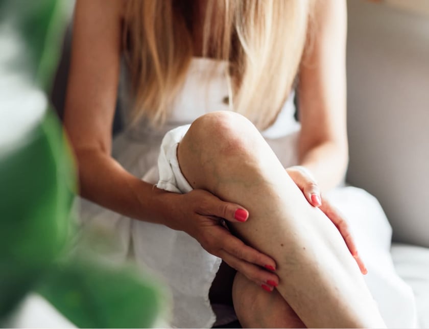 Woman at home massaging tired painful and spider varicose veins.